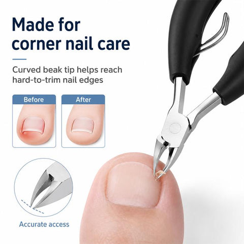Nail Clipper for Paronychia Stainless Steel Olecranon Nail Nipper, Nail Clipper
