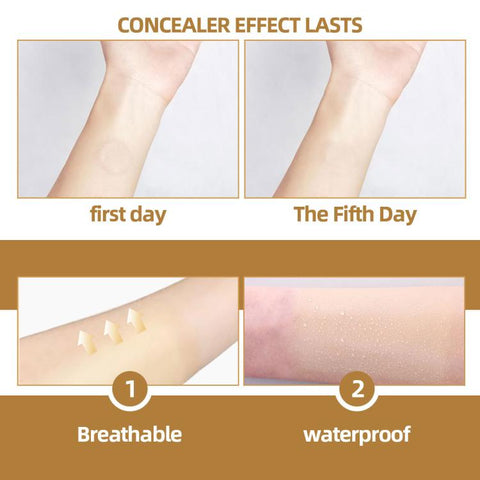 JAYSUING Waterproof Skin Scar Acne Mark Covering Patch, Acne Mark Covering Patch