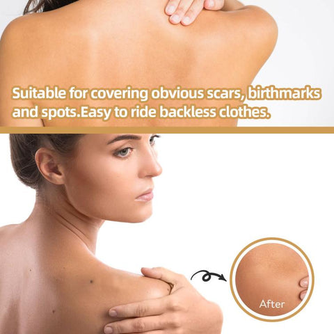 JAYSUING Waterproof Skin Scar Acne Mark Covering Patch, Acne Mark Covering Patch