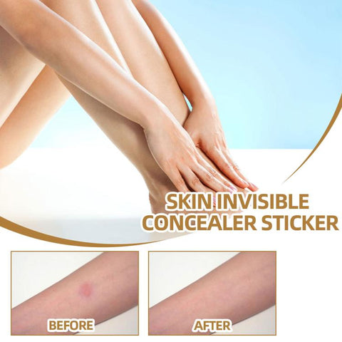 JAYSUING Waterproof Skin Scar Acne Mark Covering Patch, Acne Mark Covering Patch