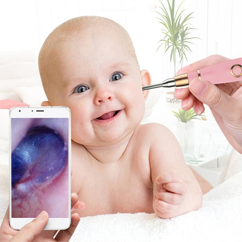 A1 WiFi Endoscope Camera 720P Ear Cleaning Wireless Safe Ear Pick Tool Visual Ear Spoon, Diameter: 3.9mm, A2