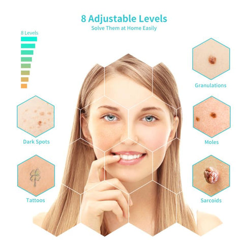 XPRE061 Professional Dark Spot Remover Freckle Tattoo Chargeable Wart Mole Remover, with LED Screen and Spotlight