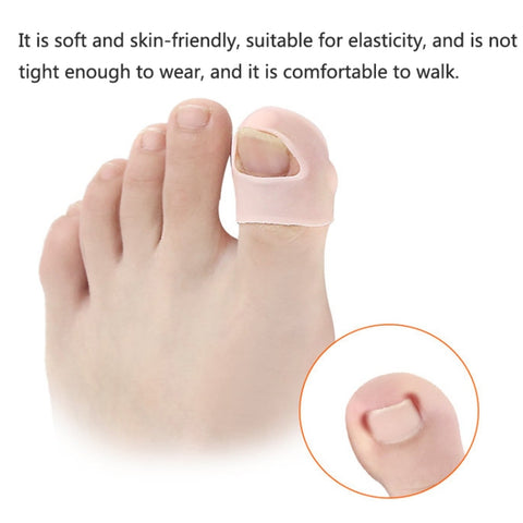 Ingrown Nails Prevent Nails From Growing Flesh Nail Corrections, Free Size