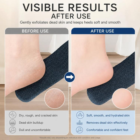 Foot File Callus Remover For Feet  5-Sided Silicon Carbide Pumice Stone With Ergonomic Bamboo Handle