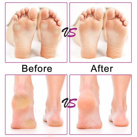 Electric Foot File Speed Adjustable Sandpaper Discs Callus Remover Pedicure Fast Remove Feet Hard Cracked Dry Dead Skin Tool, US plug, EU plug, UK plug